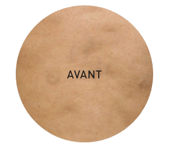 avant l'amélioration
