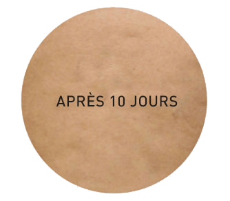 amélioration après 10 jours