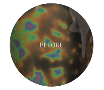 cellulite reduction