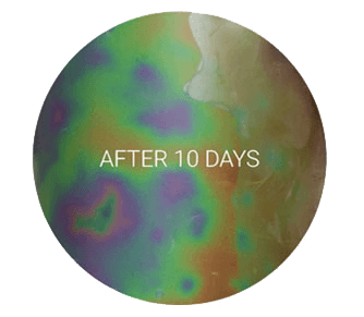 cellulite reduction after 10 days