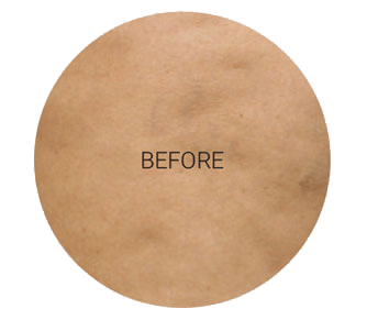 improvement before