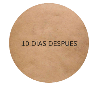 mejora despues 10 dias