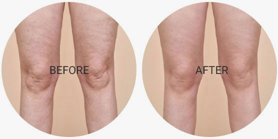 before and after treatment