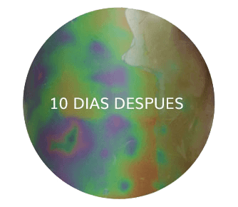 reduccion celulitis despues 10 dieas