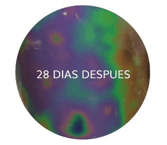 reduccion celulitis despues 28 dieas