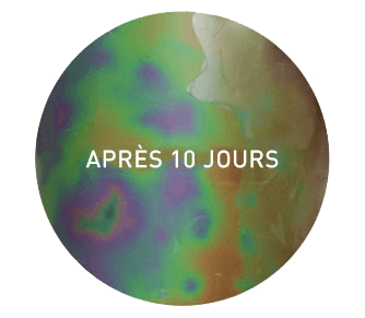 réduction cellulite après 10 jours