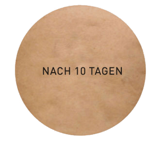 Verbesserung nach 10 Tagen
